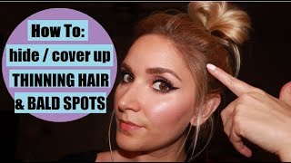 How To Hide THINNING HAIR  BALD SPOTS with eyeshadow [upl. by Tedder]