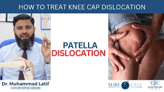 How to treat knee cap dislocation Patella Dislocation  Dr Latif [upl. by Ahsikar137]