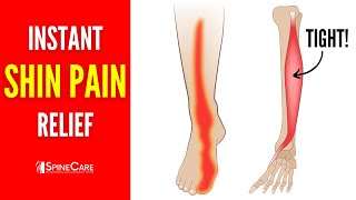 How to Instantly Relieve Shin Pain [upl. by Roana]