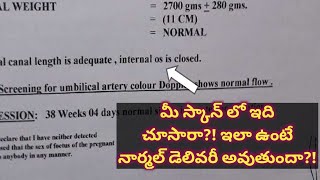 Internal OS is closed in ultrasound  Pregnancy  Mom Geethas Tips [upl. by Rhona964]