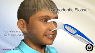 How to use an orthodontic flosser [upl. by Appolonia668]