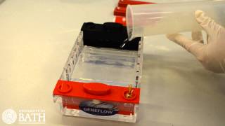 Agarose Gel Electrophoresis of DNA fragments amplified using PCR [upl. by Nerti]