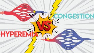 Mnemonics Hyperemia Vs Congestion Pathology  Acute Inflammation [upl. by Enenaj]