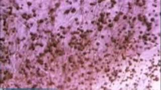 Penicillium Mold Growth [upl. by Silbahc]