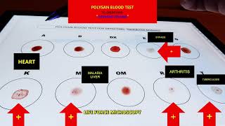 Whats Hiding in Your BLOOD TEST Results [upl. by Nhtanhoj]