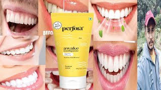 Perfora Awake Toothpaste  Honest Review [upl. by Aisyat31]