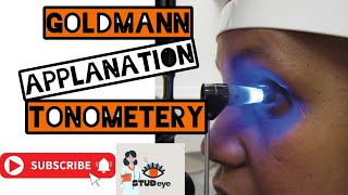 Goldmann Applanation Tonometer  Tonometry [upl. by Ingemar749]