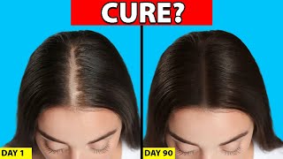 Womens Hair Loss Treatments That ACTUALLY WORK [upl. by Archibaldo]