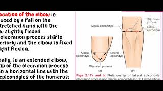 Dislocation of elbow jointclinical anatomy of elbow jointupper limb anatomyin Tamil [upl. by Akemrehs21]