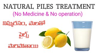 పైల్స్  మొలలు కి ఇంట్లొనె చికిత్స తీసుకోవచ్చు  piles treatment at home  piles treatment in telugu [upl. by Xel]