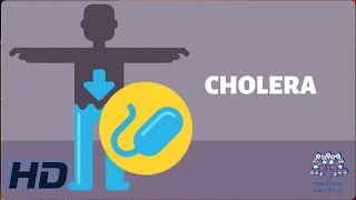 CHOLERA Everything You Need To Know [upl. by Lyret]