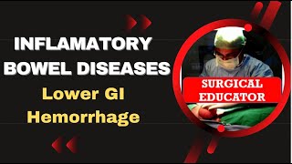 INFLAMMATORY BOWEL DISEASE  How To DIAGNOSE amp TREAT Lower GI Hemorrhage [upl. by Peednama]