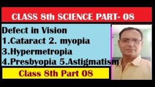 Class 8th  light  cataract  defect in vision [upl. by Fulviah]