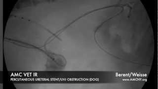 AMC IR perc ureteral stent TCC [upl. by Jecoa]