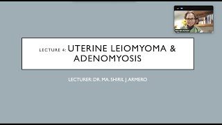 LEIOMYOMA and ADENOMYOSIS [upl. by Anilorak939]