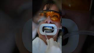 Teeth Whitening ASMR [upl. by Orson]