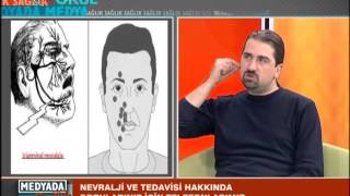 Nevralji nedir nasıl tedavi edilir [upl. by Eldred405]