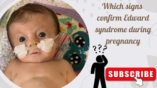 Edward syndrome  trisomy 18 signs on ultrasound Part 1 [upl. by Yemaj]