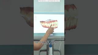 ✨ Invisalign en Clínica BDental con la Dra Stephanie Lewy ✨ [upl. by Brunhilda]