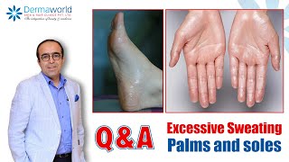 QnA with Dr Rohit Batra  Excessive Sweating Palms and soles  Hyperhidrosis Treatment  In Hindi [upl. by Rezzani354]