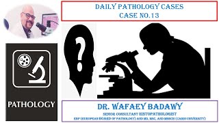 DAILY PATHOLOGY CASES CASE NO 13 BY Dr WAFAEY BADAWY [upl. by Olin]