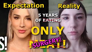 Mikhaila Peterson caught LYING for 5 years LION DIET FAILED HER mikhaila [upl. by Eb433]