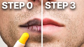 How To Treat Chapped Lips in 3 Easy Steps Dermatologist [upl. by Wickman9]