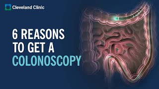 6 Reasons to Get a Colonoscopy [upl. by Anovad87]