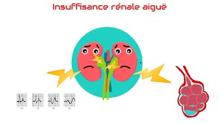 Insuffisance rénale aiguëdéfinition et classification [upl. by Thill]