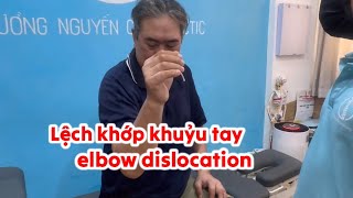 Trật khớp khuỷu tay elbow dislocation elbowdislocation elbowpain tratkhopkhuyutay [upl. by Mcgrody146]