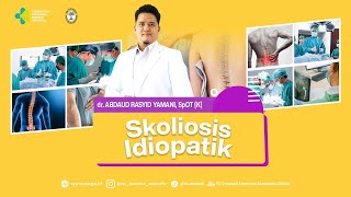 SKOLIOSIS IDIOPATIK  Skoliosis karena Bakat [upl. by Uta]