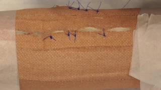 Vertical Mattress Suture [upl. by Arda]