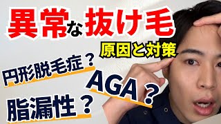 【薄毛の前兆？】髪の毛が異常に抜ける原因と対策 [upl. by Cooe]