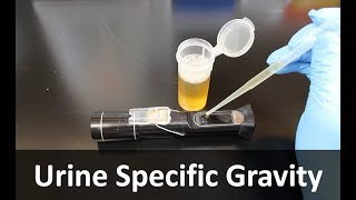 Urine Specific Gravity Refractometer [upl. by Annodam]