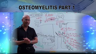 Osteomyelitis  Causes amp Symptoms  Bone Infection🩺 [upl. by Bernarr]