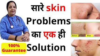 Berberis aquifolium gel for skin  berberis aquifolium uses in hindi  Homeopathic gel for fairness [upl. by Ursuline]