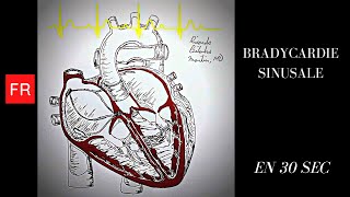 Arythmies Animation cardiaque et ECG  Bradycardie Sinusale Shorts [upl. by Eda]