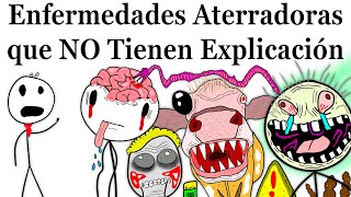 Enfermedades Más Aterradoras que la Ciencia NO Puede Explicar [upl. by Anuahsar]