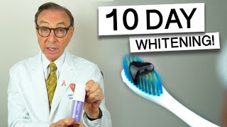 Hismile Purple Toothpaste for 10 Days  Dentist Review teethwhitening [upl. by Krawczyk]