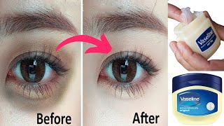 Remove Dark Circles in 3 days with Vaseline Permanently  Dark circles under eyes home remedy [upl. by Willock840]