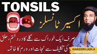 Tonsils in Throat  Treatment of Tonsils at home  Tonsils ka ilaj  Gale ke Tonsil ka ilaj [upl. by Fronia]