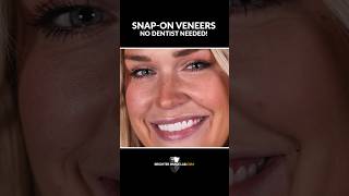 Snapon Veneers An Easy amp Quick Solution for a Bright Smile [upl. by Oberstone]