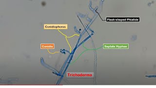 Conidia Phialides and Conidiophores of Trichoderma in LPCB Preparation [upl. by Roley]