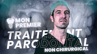 Mon Premier Traitement Parodontal NON CHIRURGICAL [upl. by Nerret2]