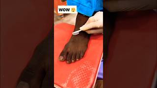 Permanent Feet Dirt amp Tanning Removal PackMost Easy Pedicure diy ytshorts shorts [upl. by Otsirave496]