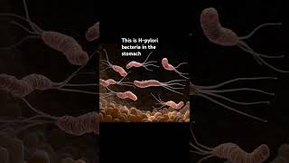 The H pylori bacteria that causes ulcers [upl. by Assenar]