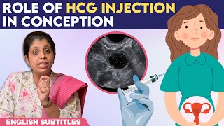 Role Of hCG Injection In Conception  hCG ஊசி செலுத்திய பிறகு கரு முட்டை எப்போது வெளிவரும் [upl. by Allenad]