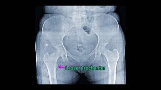 Pelvis X ray Anatomy in 30 second shortsvideo [upl. by Bullion]