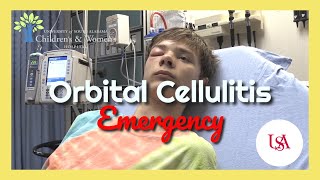 Orbital Cellulitis Emergency [upl. by Opaline781]