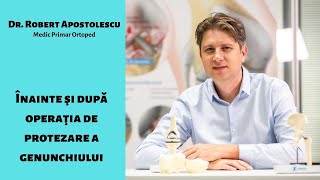 Inainte si dupa protezarea genunchiului  Dr Robert Apostolescu [upl. by Assenal]